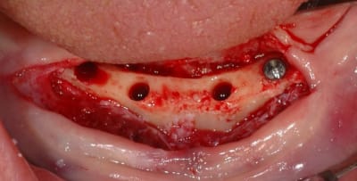 2015 11 5 3 n6lam1 - Eugenol