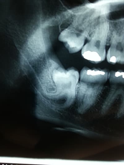 20150602 121619 vcw3nh - Eugenol