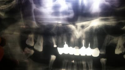 20160123 135531 ufyik4 - Eugenol