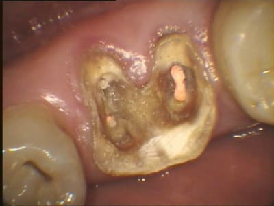 215 oaquzi - Eugenol