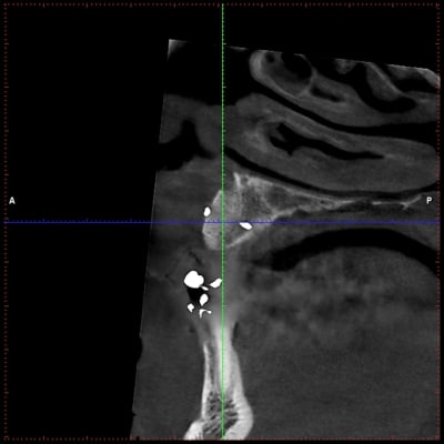 21 apres ltq0lx - Eugenol