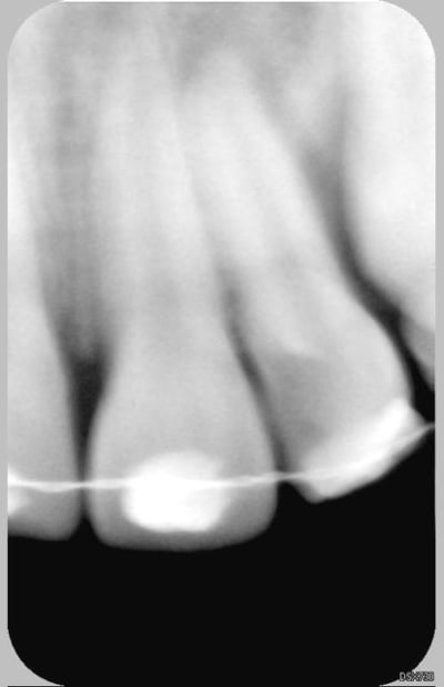 22 21 19 4 2006 x9j9wx - Eugenol