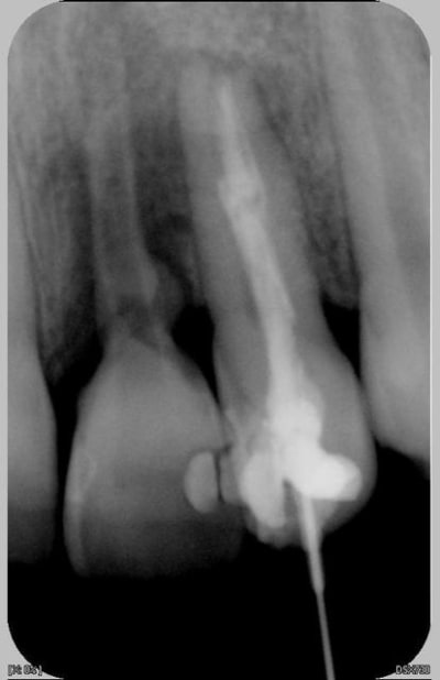 22 21 30 2 2007 ccloid - Eugenol