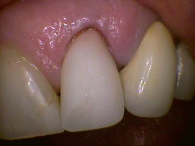 22 multi usinee - Eugenol