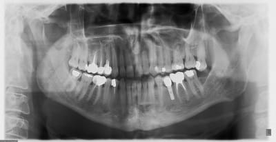 22janvier2013 goth2p - Eugenol