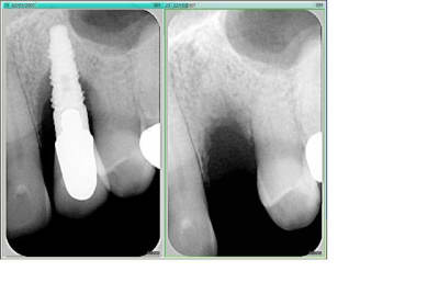 23 1 2 nur7tc - Eugenol
