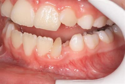 24022010 laterale supplementaire 001  small  oyg4ff - Eugenol