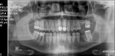 29052013 field.david.mr - Eugenol