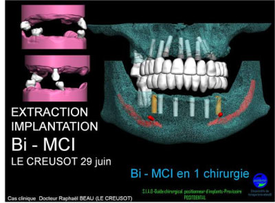 29 juin qugvfz - Eugenol