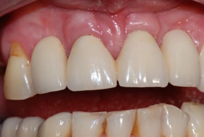 2  11 et 21 h1qliy - Eugenol