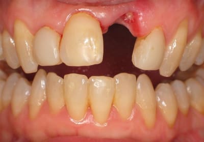 2  large  ky6zkq - Eugenol