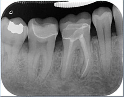 2 ans p o d4mgb4 - Eugenol