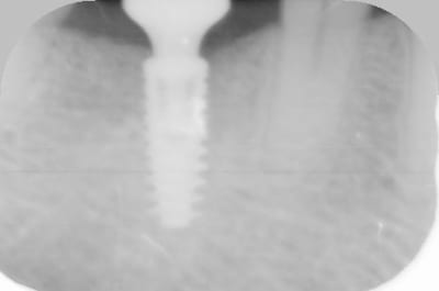 2mois d7hu6i - Eugenol