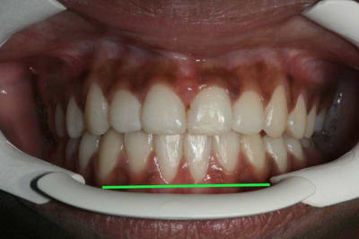 31 copie lklevy - Eugenol