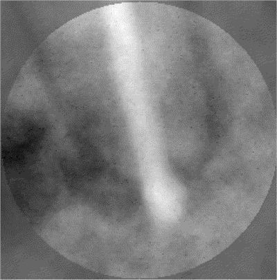 35 dévitalisation b pmipzw - Eugenol