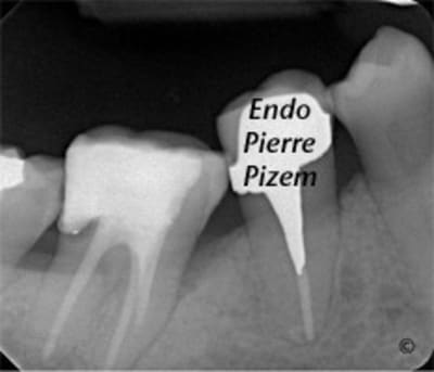 368744post op3 zdx4zc - Eugenol