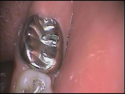 36 cr ion andres  medium  u1wljl - Eugenol