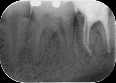 37   lentulo o9e2xu - Eugenol