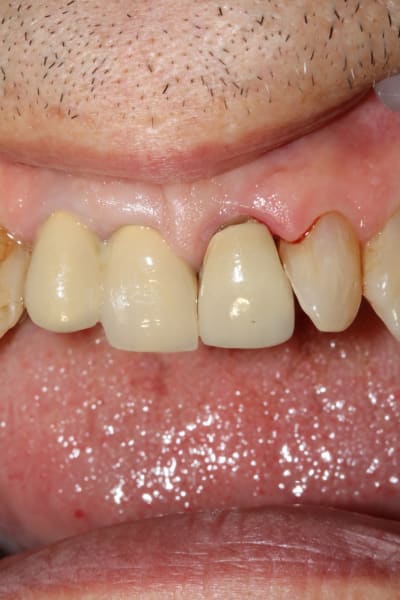 38ohpssgksqk1rpfpq6309iedjiw - Eugenol