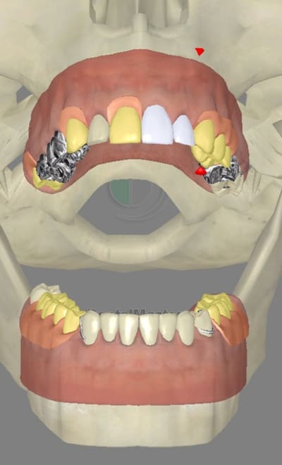 3dscreenshot100 a571pj - Eugenol