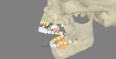 3dscreenshot102 lrgzjb - Eugenol