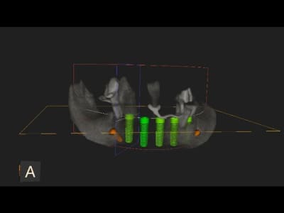 3dslice1 2011 06 19 21 04 50 xijhbl - Eugenol