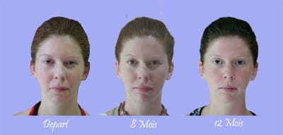 3 visages de face mgk4im - Eugenol