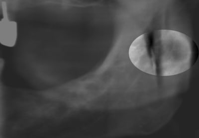 3 copie d6gox2 - Eugenol
