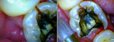 3 w3s6in - Eugenol