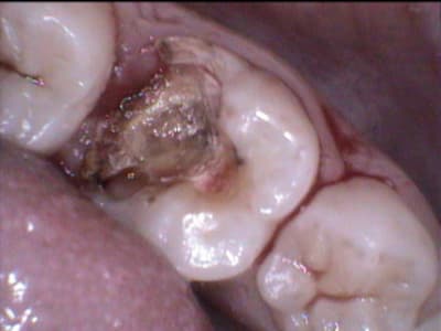 3 z0hg5n - Eugenol