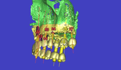 3d11 ytb0l3 - Eugenol