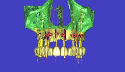 3d12 khdie9 - Eugenol