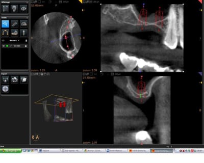 3d pr  op kspfbf - Eugenol
