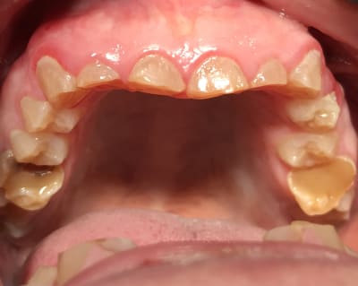 40edc7b8 ac35 4fb0 a890 d3676a6f086c zc7npz - Eugenol