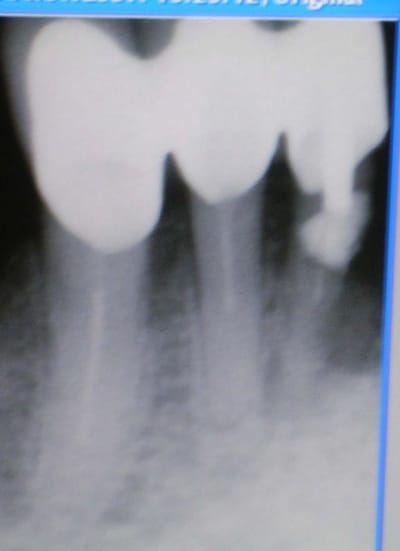 41bis vikwee - Eugenol