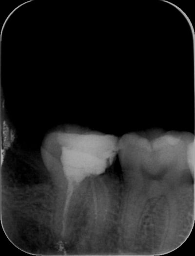 47   double lentulo uq6smu - Eugenol