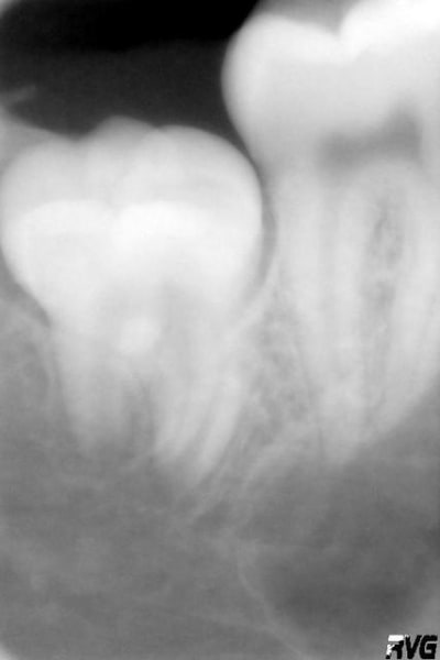 48 47 fy0m9e - Eugenol
