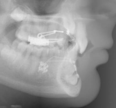 4 canines tele pjw3hq - Eugenol