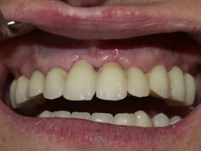 4 cas clinique dr l audibert pamiers  apqyq2 - Eugenol