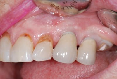 4 merci z1 uihlmr - Eugenol