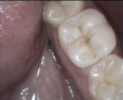 4 qoitw1 - Eugenol