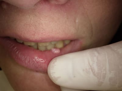 4i95vtmojpsbmsff32eah5fo3vey - Eugenol