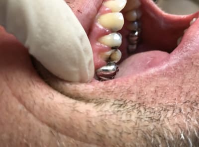 5d73f116 9c83 42a5 bc54 37f4006ecd7f v2b0lc - Eugenol