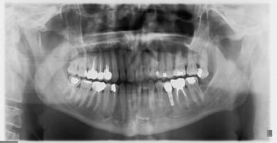 5ans mdnoxz - Eugenol
