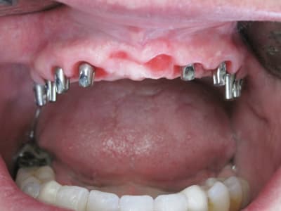 6 cas clinique dr l audibert pamiers  ldjmiw - Eugenol