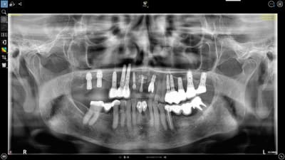 6a7zhir2q18d2fdhmordrqcvdape - Eugenol