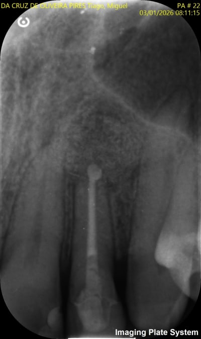 6qj0aa0dhicwliobpb6eusl6683d - Eugenol