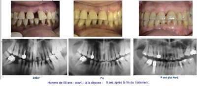 7406 9 ans pph8uy - Eugenol