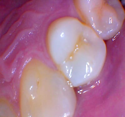 740md 2016 12 22 160723 mo957a - Eugenol