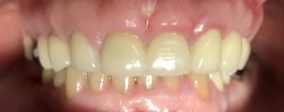 7c86dd76 e3f3 4788 b73c 9c7dada283ab v1gkvo - Eugenol